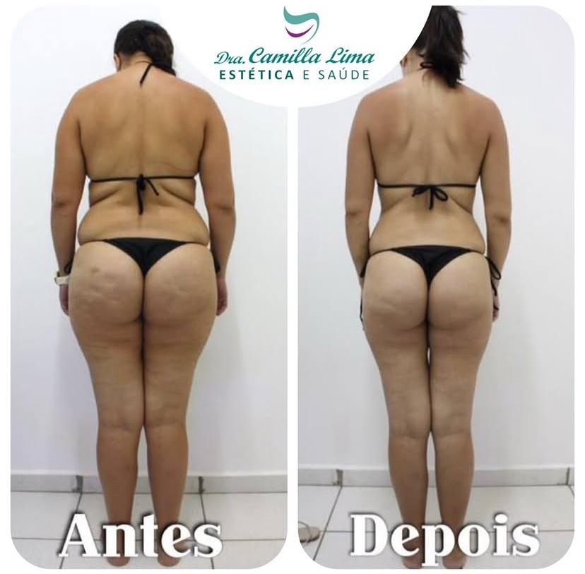 Resultado antes e depois 2