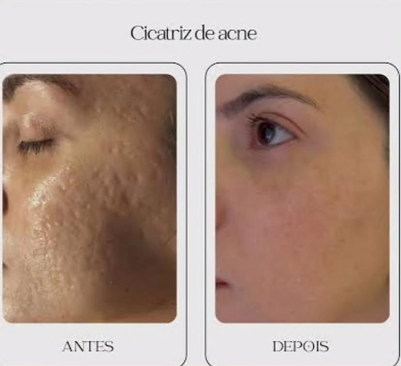 Resultado antes e depois 4