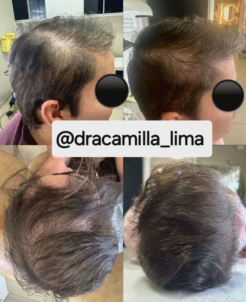 Resultado antes e depois 7